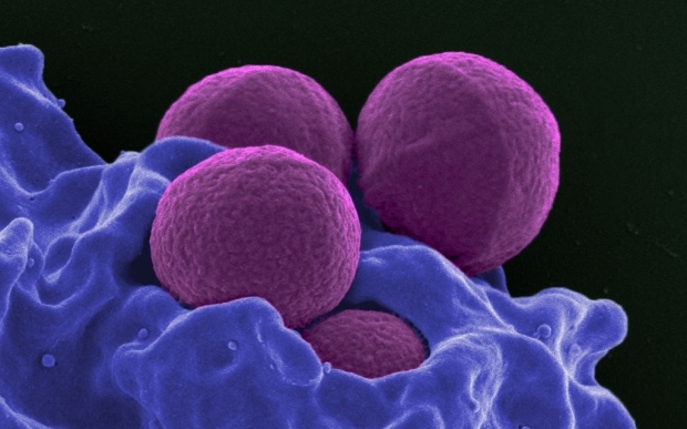 Human neutrophil ingesting MRSA